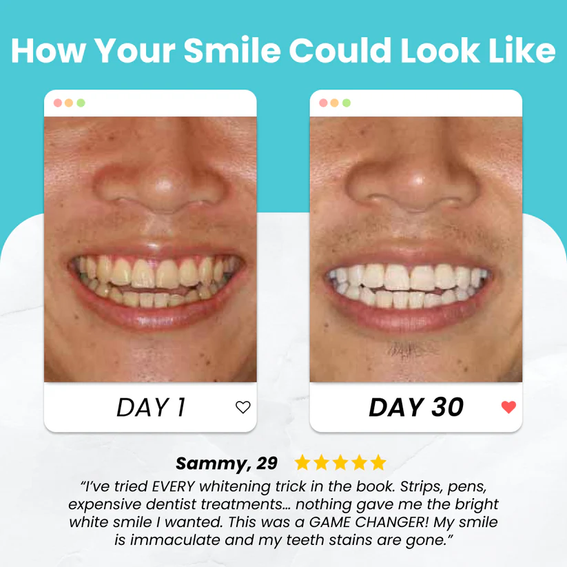 Flanora® SmartBrush – Dentist-Level Clean in Just 30 Seconds