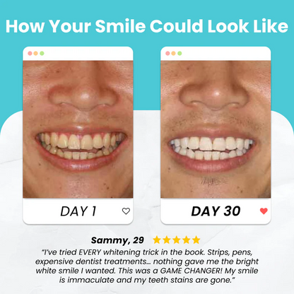 Flanora® SmartBrush – Dentist-Level Clean in Just 30 Seconds