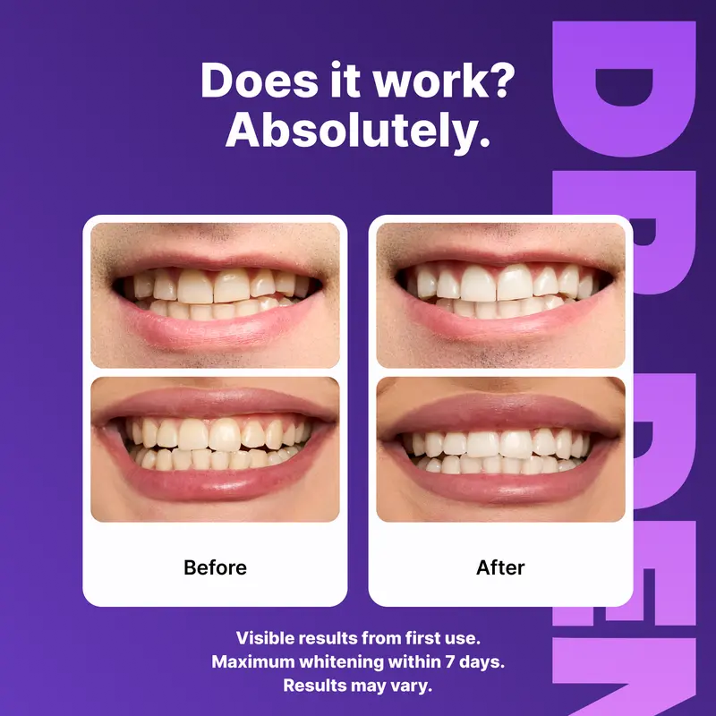 🦷Purple Teeth Whitening Strips🦷 - 7/21 Whitening Sessions - Safe for Enamel - Non Sensitive Teeth Whitening - Peroxide-Free