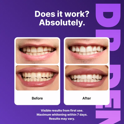 🦷Purple Teeth Whitening Strips🦷 - 7/21 Whitening Sessions - Safe for Enamel - Non Sensitive Teeth Whitening - Peroxide-Free