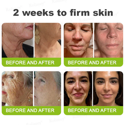 ✨👨‍⚕️ Doctor-Grade Wrinkle Lift You Can See | Botox & Retinol Wrinkle-Lift Cream | 💯 Full Refund If No Results | 🔥 Last Day 70% OFF