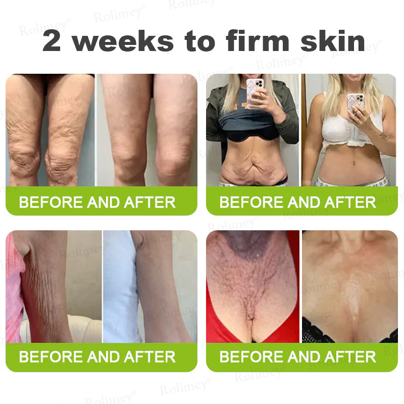 ✨👨‍⚕️ Doctor-Grade Wrinkle Lift You Can See | Botox & Retinol Wrinkle-Lift Cream | 💯 Full Refund If No Results | 🔥 Last Day 70% OFF
