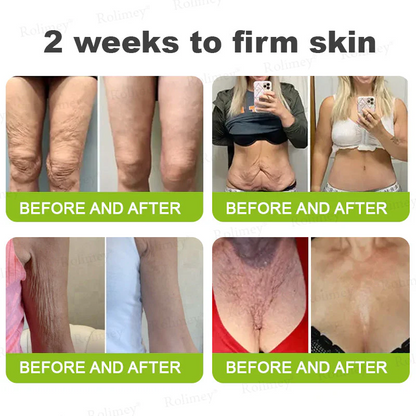 ✨👨‍⚕️ Doctor-Grade Wrinkle Lift You Can See | Botox & Retinol Wrinkle-Lift Cream | 💯 Full Refund If No Results | 🔥 Last Day 70% OFF