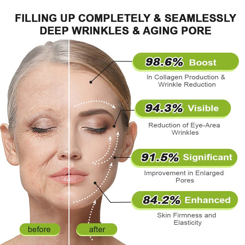 ✨👨‍⚕️ Doctor-Grade Wrinkle Lift You Can See | Botox & Retinol Wrinkle-Lift Cream | 💯 Full Refund If No Results | 🔥 Last Day 70% OFF