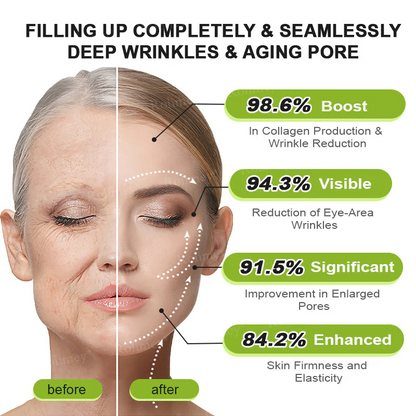 ✨👨‍⚕️ Doctor-Grade Wrinkle Lift You Can See | Botox & Retinol Wrinkle-Lift Cream | 💯 Full Refund If No Results | 🔥 Last Day 70% OFF